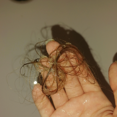 PostPartum or menopausal hair loss