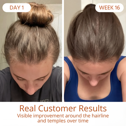 Verda Vita™ Hair Renewal Complex